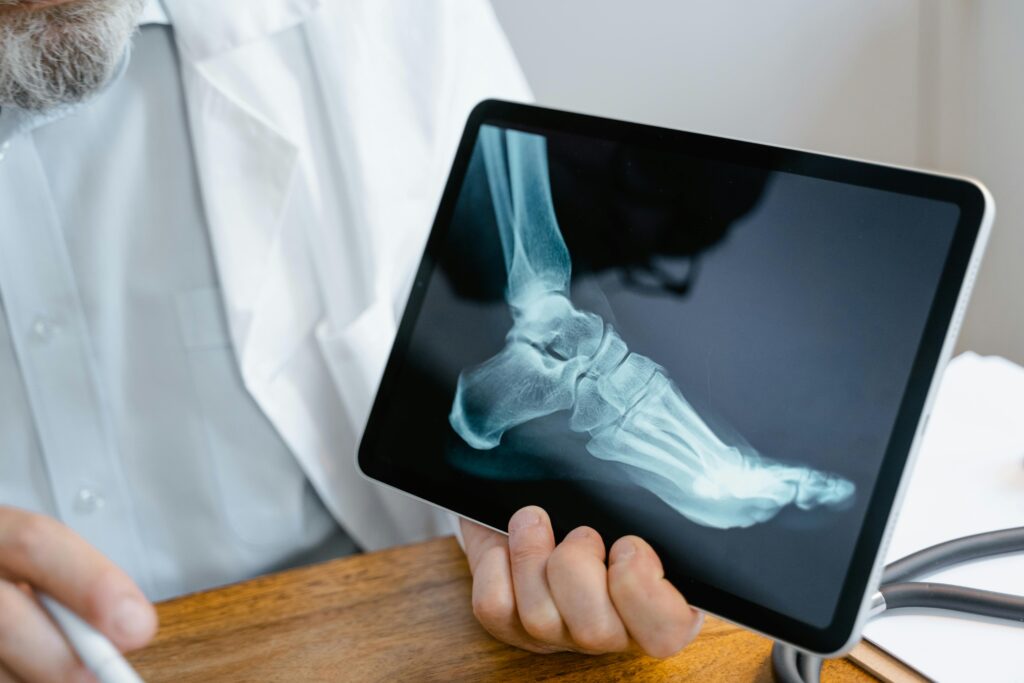 Bone Health